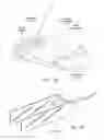 Fig. 14 - Methods and apparatus for testing disruption of a vagal nerve