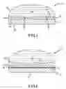 Fig. 03 - Device and method for high intensity focused ultrasound ablation with acoustic lens