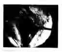 Fig. 01 - Methods for Intraoperative Organotypic Nerve Mapping