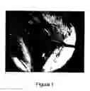 Fig. 02 - Methods for Intraoperative Organotypic Nerve Mapping