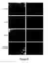 Fig. 06 - Methods for Intraoperative Organotypic Nerve Mapping