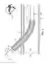 Fig. 02 - Light-guided transluminal catheter