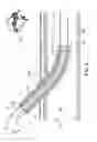 Fig. 03 - Light-guided transluminal catheter