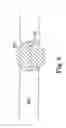 Fig. 06 - Light-guided transluminal catheter