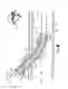 Fig. 07 - Light-guided transluminal catheter