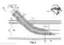 Fig. 09 - Light-guided transluminal catheter