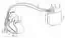 Fig. 01 - Rapid thermal detection of cardiac output change