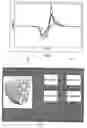 Fig. 06 - Heart analysis method and apparatus