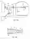 Fig. 11 - SYSTEM AND METHOD FOR MINIMALLY INVASIVE DISEASE THERAPY