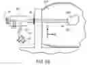 Fig. 17 - SYSTEM AND METHOD FOR MINIMALLY INVASIVE DISEASE THERAPY