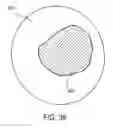 Fig. 24 - SYSTEM AND METHOD FOR MINIMALLY INVASIVE DISEASE THERAPY