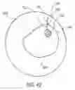 Fig. 30 - SYSTEM AND METHOD FOR MINIMALLY INVASIVE DISEASE THERAPY