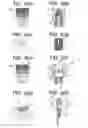Fig. 07 - Biosensor Unified With Needle