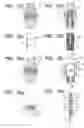 Fig. 08 - Biosensor Unified With Needle