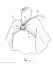 Fig. 06 - Systems and methods for applying ultrasonic energy to the thoracic cavity