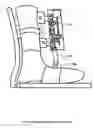 Fig. 01 - Method and devices for moving a body joint