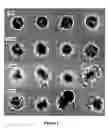 Fig. 02 - Treating Disorders Associated with Inflammation