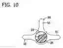 Fig. 11 - Medical valve device