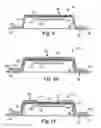 Fig. 06 - Collapsible Patch and Method of Application