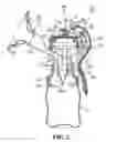 Fig. 03 - Breast pump