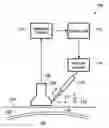 Fig. 01 - Cannula Inserting System