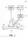 Fig. 02 - Cannula Inserting System