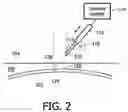 Fig. 03 - Cannula Inserting System