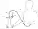 Fig. 01 - ENTERAL FEEDING SYSTEMS, DEVICES AND METHODS