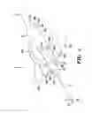 Fig. 02 - Winged needle with needle shield