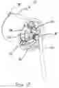 Fig. 16 - Revolving tissue sample holder for biopsy device