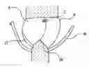 Fig. 01 - Disposable absorbent article with separate part