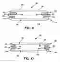 Fig. 08 - Tucked fastener for improved fastener performance