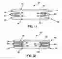 Fig. 09 - Tucked fastener for improved fastener performance