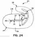 Fig. 15 - Tucked fastener for improved fastener performance