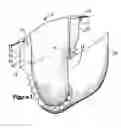 Fig. 02 - Diaper fastener