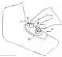Fig. 01 - VALVED DELIVERY DEVICE AND METHOD OF DELIVERING A SUBSTANCE TO A PATIENT