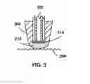 Fig. 03 - APPARATUS FOR LASER INTERACTION WITH BIOLOGICAL TISSUES