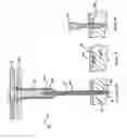 Fig. 08 - Orthopaedic Helical Coil Fastener and Apparatus and Method for Implantation Thereof