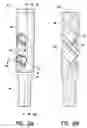 Fig. 03 - Intramedullary nail system and method for fixation of a fractured bone
