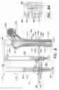 Fig. 07 - Intramedullary nail system and method for fixation of a fractured bone