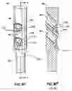 Fig. 17 - Intramedullary nail system and method for fixation of a fractured bone