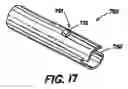 Fig. 18 - Intramedullary nail system and method for fixation of a fractured bone