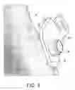 Fig. 06 - Device, system and method for positioning or preparing the positioning of a medical operating instrument