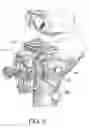 Fig. 09 - Device, system and method for positioning or preparing the positioning of a medical operating instrument