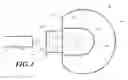 Fig. 02 - Apparatus and method for hip cup extraction