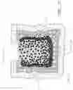 Fig. 06 - VERTEBROPLASTY METHODS WITH OPTIMIZED SHEAR STRENGTH AND CRACK PROPAGATION RESISTANCE