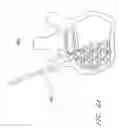 Fig. 07 - VERTEBROPLASTY METHODS WITH OPTIMIZED SHEAR STRENGTH AND CRACK PROPAGATION RESISTANCE