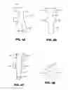 Fig. 07 - Methods and devices for bone, joint, and ligament reconstruction with bands