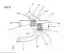 Fig. 04 - Device for end-to-side anastomosis