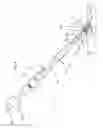 Fig. 05 - Device for end-to-side anastomosis